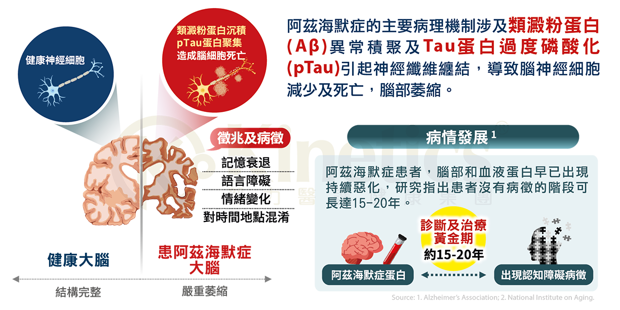 阿茲海默症主要病理